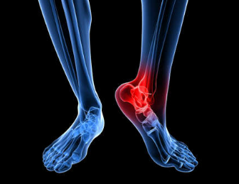 Foot and Ankle Surgery